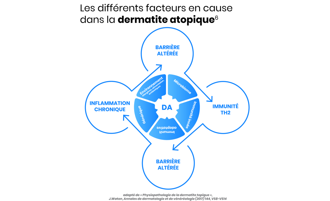 Les differents facteurs en cause dans la DA